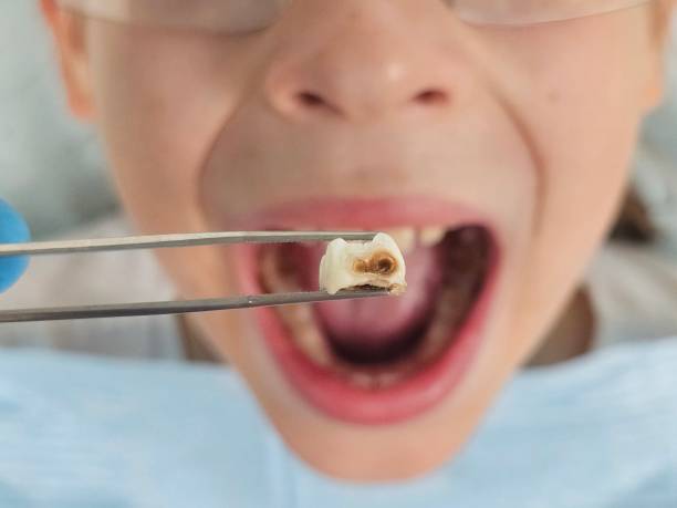 Best Emergency Gum Treatment in Church Hill, PA